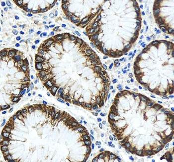 IHC staining of FFPE human stomach tissue with TJP2 antibody, HRP-secondary and DAB substrate. HIER: boil tissue sections in pH8 EDTA for 20 min and allow to cool before testing.