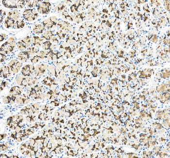 IHC staining of FFPE human stomach tissue with TJP2 antibody, HRP-secondary and DAB substrate. HIER: boil tissue sections in pH8 EDTA for 20 min and allow to cool before testing.