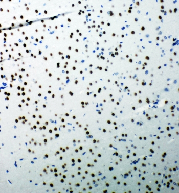IHC-P: 53BP1 antibody testing of rat brain tissue. HIER: steamed with pH6 citrate buffer.