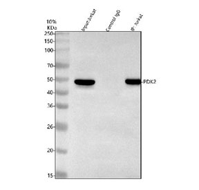 Immunoprecipitation of PDK2 protein from 500ug of human Jurkat whole cell lysate with 2ug of PDK2 antibody.