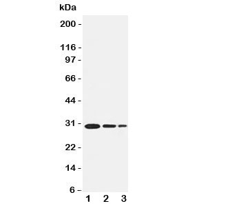 Western blot testing of TRAF1 antbody and recombinant human protein, 30.6KD with tag;  Lane 1: 5ng;  2: 2.5ng;  3: 1.25ng