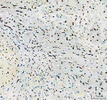 Flotillin 1 Antibody Mouse Brain IHC. IHC staining of FFPE mouse brain tissue with Flotillin 1 Antibody. HIER was performed by boiling tissue sections in pH 8 EDTA buffer for 20 minutes, followed by cooling prior to staining. The section was incubated with Flotillin 1 antibody, followed by detection using HRP-secondary and DAB chromogen. Flotillin 1 Antibody / Lipid Raft Marker Antibody demonstrates staining consistent with FLOT1 expression and supports studies of lipid raft organization, membrane microdomains, vesicle trafficking and neuronal cell biology pathways.