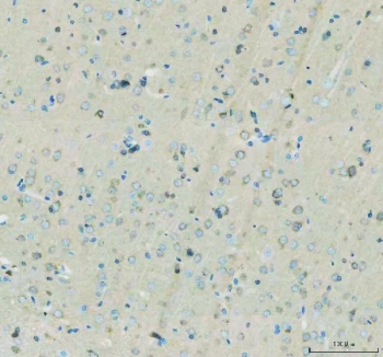 Flotillin 1 Antibody Rat Brain IHC. IHC staining of FFPE rat brain tissue with Flotillin 1 Antibody. HIER was performed by boiling tissue sections in pH 8 EDTA buffer for 20 minutes, followed by cooling prior to staining. The section was incubated with Flotillin 1 antibody, followed by detection using HRP-secondary and DAB chromogen. Flotillin 1 Antibody / Lipid Raft Marker Antibody demonstrates staining consistent with FLOT1 expression and supports studies of lipid raft organization, membrane-associated signaling and neuronal membrane biology.