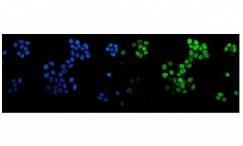 p63 Antibody A431 IF. Immunofluorescent staining of FFPE human A431 cells with p63 antibody (green) and DAPI nuclear stain (blue). HIER: steam section in pH6 citrate buffer for 20 min.
