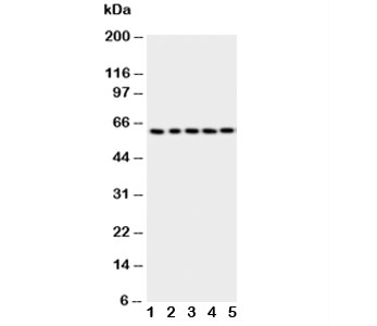 p63 Antibody Human Cell Line WB. Western blot testing of human 1) HeLa, 2) SMMC-7721, 3) COLO-320, 4) A549 and 5) SGC-7901 cell lysate with p63 antibody. Expected molecular weight: 63-77 kDa.