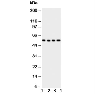 GLUT5 Antibody Human Cell Lines WB. Western blot analysis of GLUT5 expression using a GLUT5 antibody. Lane 1: human U87 cell lysate. Lane 2: human 293T cell lysate. Lane 3: human HT1080 cell lysate. Lane 4: human SW620 cell lysate. GLUT5, also known as SLC2A5 and Fructose Transporter Protein, is a facilitative transporter that mediates fructose uptake and contributes to carbohydrate metabolism and cellular energy homeostasis. A prominent band is detected at approximately 55 kDa in all cell lines, consistent with the expected molecular weight of GLUT5. These results demonstrate endogenous expression of this fructose transporter in diverse human cell types and support the utility of GLUT5 Antibody for studies of nutrient transport, metabolic regulation, and cancer metabolism.