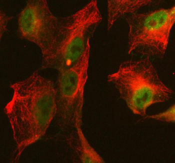 Immunofluorescent staining of FFPE human A549 cells with ABI2 antibody (green) and Alpha Tubulin mAb (red). HIER: steam section in pH6 citrate buffer for 20 min.