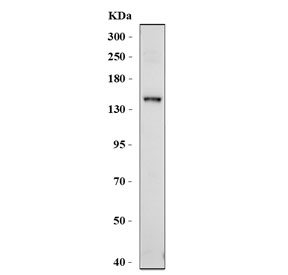 Western blot testing of ABCB4 antibody and human HepG2 cell lysate. Predicted molecular weight ~142 kDa.