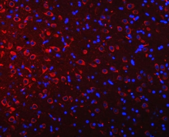Immunofluorescent staining of FFPE rat brain tissue with Ataxin-2 antibody (red) and DAPI nuclear stain (blue). HIER: steam section in pH8 EDTA buffer for 20 min.