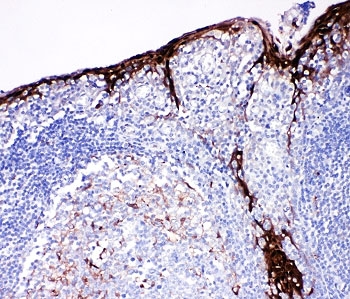 Cystatin A Antibody Tonsil Immunohistochemistry. IHC-P: Cystatin A antibody testing of human tonsil tissue