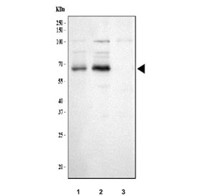Western blot testing of human 1) A431, 2) HepG2 and 3) MCF7 cell lysate with PCSK9 antibody. Predicted molecular weight: ~74 kDa (pro form), ~64 kDa (mature form).