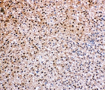IHC-P: VCP antibody testing of rat epinephros tissue