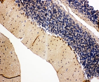 IHC-P: VCP antibody testing of rat cerebellum tissue