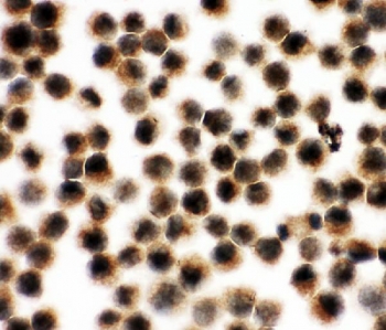Immunocytochemical staining of FFPE human K562 cells with VCP antibody. HIER: steam section in pH6 citrate buffer for 20 min.
