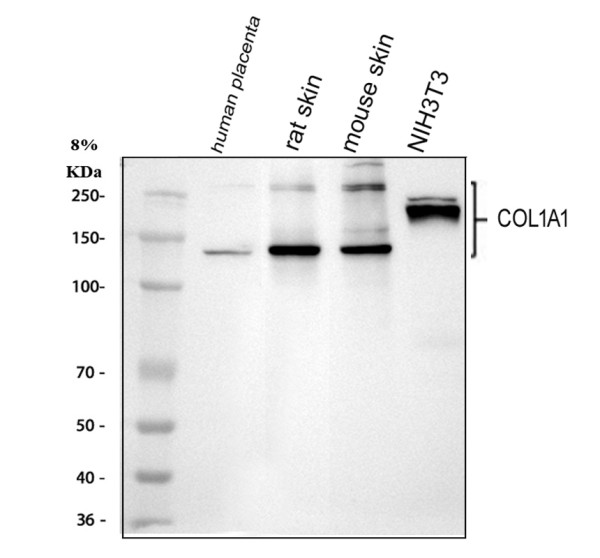 Collagen 1 Antibody / COL1A1 Extracellular Matrix Antibody Multi-Species WB. Western blot analysis of 1) human placenta tissue, 2) rat skin tissue, 3) mouse skin tissue, and 4) mouse NIH/3T3 cell lysates using Collagen 1 Antibody / COL1A1 Extracellular Matrix Antibody. Specific immunoreactive bands are detected at approximately 130, 220, and 250 kDa, consistent with the expected migration of Collagen I alpha 1 and higher molecular weight collagen species. The predicted molecular weight of the COL1A1 alpha chain is approximately 138 kDa.