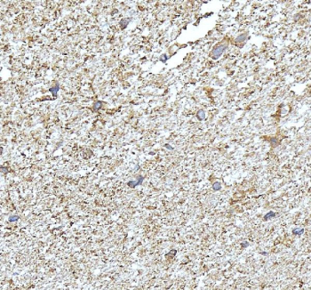 Immunohistochemical staining of FFPE human brain tissue with NDRG2 antibody, HRP-secondary and DAB substrate. HIER: boil tissue sections in pH8 EDTA for 20 min and allow to cool before testing.