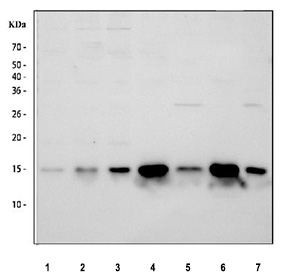 Western blot testing of 1) human U-251, 2) human RT-4, 3) human SH-SY5Y, 4) rat brain, 5) rat skeletal muscle, 6) mouse brain and 7) mouse skeletal muscle tissue lysate with Profilin 2 antibody.  Predicted molecular weight ~15 kDa.