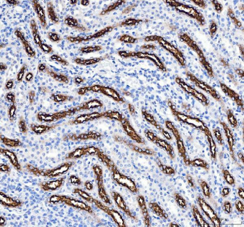 IHC staining of FFPE rat kidney tissue with NKCC2 antibody, HRP-secondary and DAB substrate. HIER: boil tissue sections in pH8 EDTA for 20 min and allow to cool before testing.