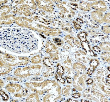 IHC staining of FFPE human kidney tissue with NKCC2 antibody, HRP-secondary and DAB substrate. HIER: boil tissue sections in pH8 EDTA for 20 min and allow to cool before testing.