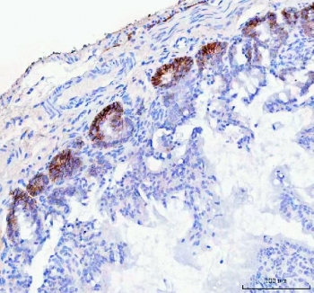 IHC staining of FFPE rat colon tissue with NKCC1 antibody. HIER: boil tissue sections in pH8 EDTA for 20 min and allow to cool before testing.