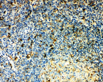 IHC-P: CCR3 antibody testing of human tonsil tissue