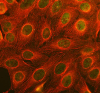Immunofluorescent staining of FFPE human U-2 OS cells with EGR2 antibody (green) and Alpha Tubulin mAb (red). HIER: steam section in pH6 citrate buffer for 20 min.