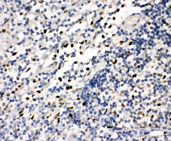 FLI1 Antibody Tonsil Immunohistochemistry. IHC-P: FLI1 antibody testing of human tonsil tissue. HIER: steamed with pH6 citrate buffer.