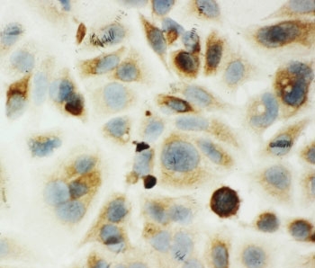 ICC testing of HYAL1 antibody and MCF-7 cells.
