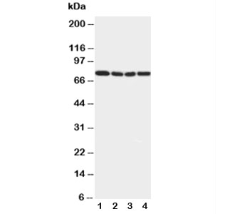 Western blot testing of IRAK1 antibody and Lane 1:  rat liver;  2: human placenta;  3: human MCF-7;  4: human PANC cell lysate. Predicted molecular weight: ~76 kDa.