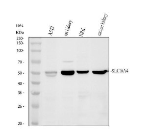 MCT5 Antibody Human, Rat and Mouse Kidney WB. Western blot analysis using MCT5 Antibody. Lane 1: human A549 cells; Lane 2: rat kidney tissue lysate; Lane 3: rat NRK cells; Lane 4: mouse kidney tissue lysate. A specific band is detected at approximately 54 kDa in all samples, consistent with the expected molecular weight of MCT5 (SLC16A4). Detection in both rodent kidney tissues and cultured epithelial cell lines supports the conserved expression of this proton-coupled monocarboxylate transporter across species. These results support the use of MCT5 Antibody / Monocarboxylate Transporter 5 Antibody for studying MCT5 expression, SLC16A4 biology and monocarboxylate transport.