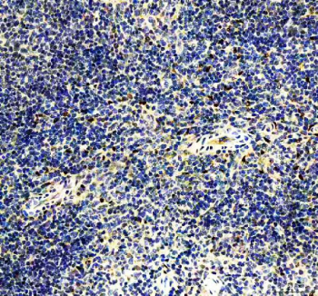 IHC staining of FFPE mouse spleen tissue with IRF8 antibody, HRP-secondary and DAB substrate. HIER: boil tissue sections in pH8 EDTA for 20 min and allow to cool before testing.