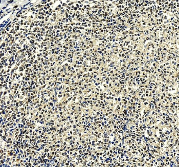 IHC staining of FFPE human tonsil tissue with IRF8 antibody, HRP-secondary and DAB substrate. HIER: boil tissue sections in pH8 EDTA for 20 min and allow to cool before testing.