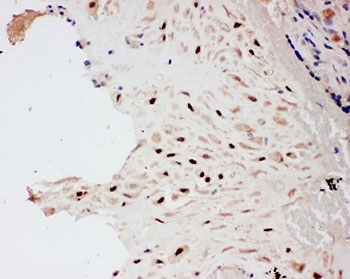 IHC-P: PIAS1 antibody testing of human placenta tissue