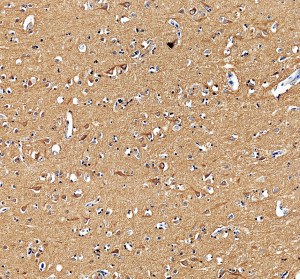RTN3 Antibody staining of human brain neurons by IHC. Immunohistochemistry of FFPE human brain sections using the RTN3 Antibody at 2 ug/ml. Strong brown staining is visible throughout the neuropil, with distinct cytoplasmic labeling of numerous neuronal cell bodies. Nuclei are counterstained blue and remain largely negative. Heat-induced epitope retrieval was performed in pH 8 EDTA buffer before overnight primary antibody incubation at 4oC. The predominantly cytoplasmic staining pattern is consistent with the intracellular membrane-associated localization of Reticulon 3 and demonstrates detection with this Reticulon 3 Polyclonal Antibody.