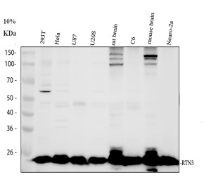 RTN3 Antibody detection in human, rat and mouse samples by WB. Western blot testing with the RTN3 Antibody under reducing conditions. Lane 1: human 293T; lane 2: human HeLa; lane 3: human U87; lane 4: human U2OS; lane 5: rat brain; lane 6: rat C6; lane 7: mouse brain; lane 8: mouse Neuro-2a. A prominent RTN3-reactive band is detected at approximately 25 kDa across the tested samples. Although the longest RTN3 isoform has a calculated molecular weight of approximately 113 kDa, multiple shorter RTN3 isoforms are reported in the approximately 24-28 kDa range, consistent with the observed migration detected by this Reticulon 3 Polyclonal Antibody.