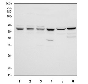 Western blot testing of 1) human 293T, 2) human HeLa, 3) human MCF7, 4) human HepG2, 5) rat testis and 6) rat C6 cell lysate with PRMT4 antibody. Predicted molecular weight ~66 kDa.