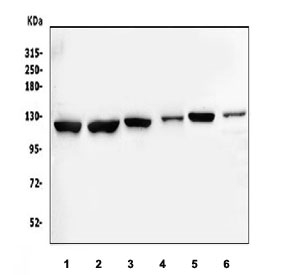 Western blot testing of 1) human HepG2, 2) human Jurkat, 3) human K562, 4) monkey kidney, 5) rat testis and 6) mouse testis tissue lysate with MERTK antibody.  Predicted molecular weight: 110-205 kDa depending on glycosylation level.