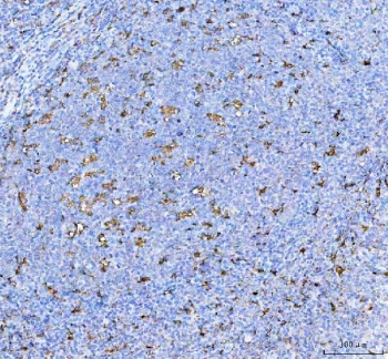 IHC staining of FFPE human tonsil tissue with IL-18 antibody. HIER: boil tissue sections in pH8 EDTA for 20 min and allow to cool before testing.