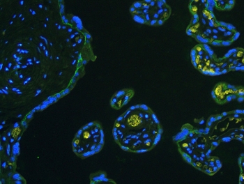 Immunofluorescent staining of FFPE human placenta with ITGB4 antibody (green) at 1ug/ml. HIER: boil tissue sections in pH6, 10mM citrate buffer, for 10-20 min and allow to cool before testing.