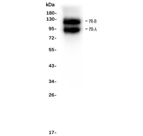 Progesterone Receptor Antibody for Western Blot analysis of Progesterone receptor / PGR. Western blot analysis was performed using human T-47D cell lysate probed with Progesterone Receptor Antibody for Western Blot. A band is detected at approximately 82-94 kDa corresponding to the predicted molecular weight of the PR-A isoform and a second band at approximately 99-120 kDa corresponding to the PR-B isoform of Progesterone receptor (PGR). These two bands represent the well-characterized PR-A and PR-B receptor isoforms generated from alternative transcription start sites of the PGR gene and are commonly observed in western blot analysis of hormone-responsive breast cancer cell lines such as T-47D.