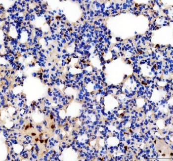 IHC staining of FFPE mouse lung tissue with IL-18 antibody. HIER: boil tissue sections in pH8 EDTA for 20 min and allow to cool before testing.