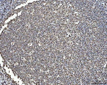 BRCA1 Antibody Tonsil IHC. Immunohistochemistry staining of FFPE human tonsil tissue with BRCA1 antibody. HIER: boil tissue sections in pH8 EDTA for 20 min and allow to cool before testing.