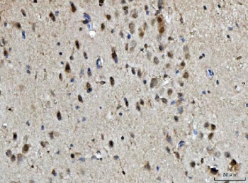 BRCA1 Antibody Mouse Brain IHC. Immunohistochemistry staining of FFPE mouse brain tissue with BRCA1 antibody. HIER: boil tissue sections in pH8 EDTA for 20 min and allow to cool before testing.