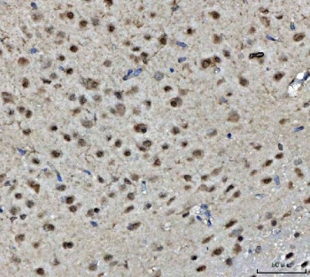 BRCA1 Antibody Rat Brain IHC. Immunohistochemistry staining of FFPE rat brain tissue with BRCA1 antibody. HIER: boil tissue sections in pH8 EDTA for 20 min and allow to cool before testing.