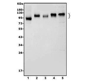 Western blot testing of 1) rat NRK, 2) mouse spleen, 3) mouse liver, 4) mouse kidney and 5) mouse ANA-1 cell lysate with ICAM1 antibody. Expected molecular weight: 75-115 kDa.