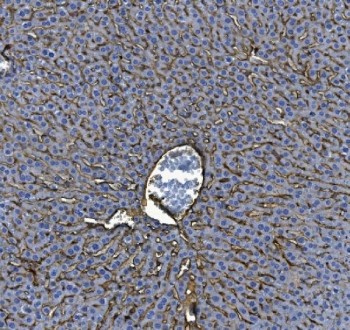 IHC staining of FFPE mouse liver tissue with ICAM1 antibody. HIER: boil tissue sections in pH8 EDTA for 20 min and allow to cool before testing.