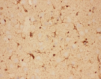IHC-P: CNTF antibody testing of rat brain tissue