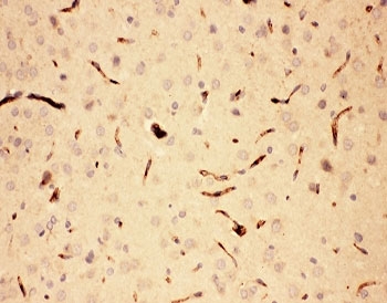 IHC-P: ACTH antibody testing of rat brain tissue