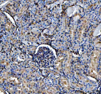 IHC staining of FFPE rat kidney tissue with Annexin V antibody, HRP-labeled secondary and DAB substrate. HIER: boil tissue sections in pH8 EDTA for 20 min and allow to cool before testing.