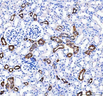 IHC staining of FFPE rat kidney tissue with Calbindin antibody. HIER: boil tissue sections in pH8 EDTA for 20 min and allow to cool before testing.